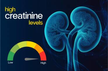 High creatinine levels