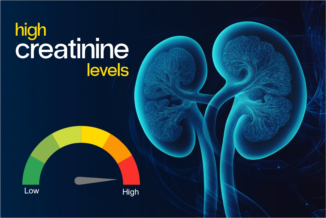 High creatinine levels